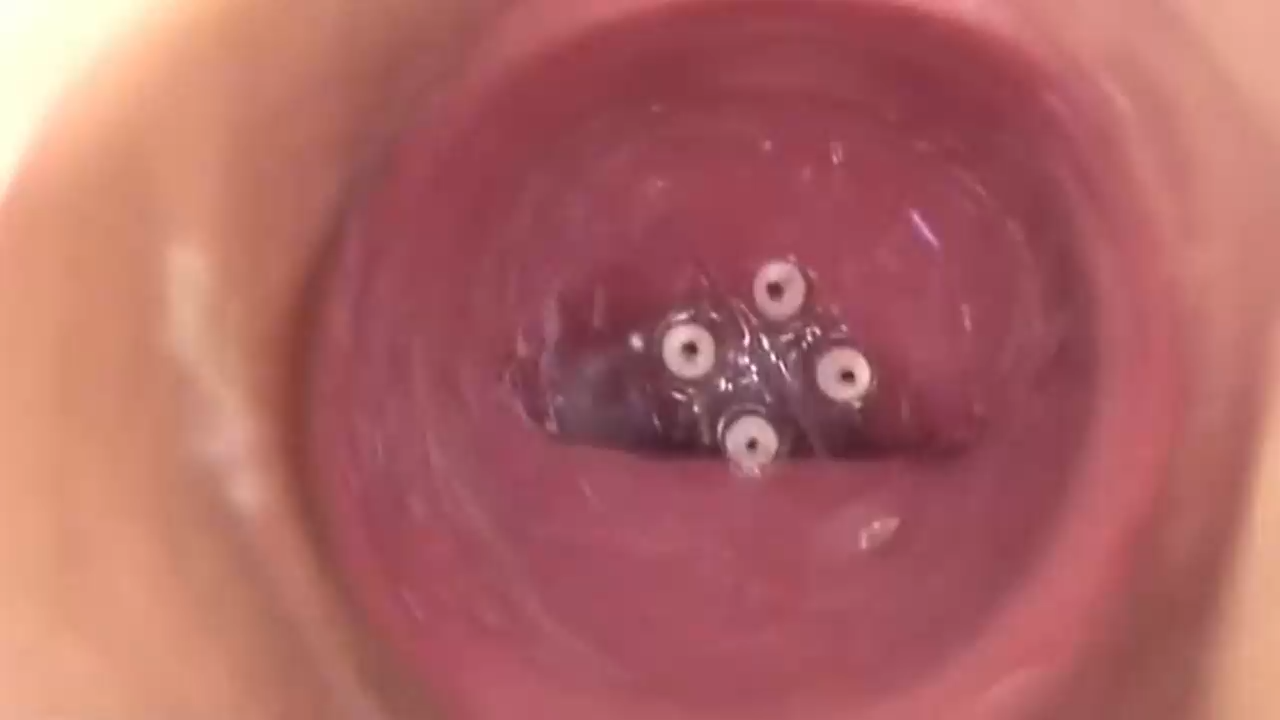 阴道中的摄像头