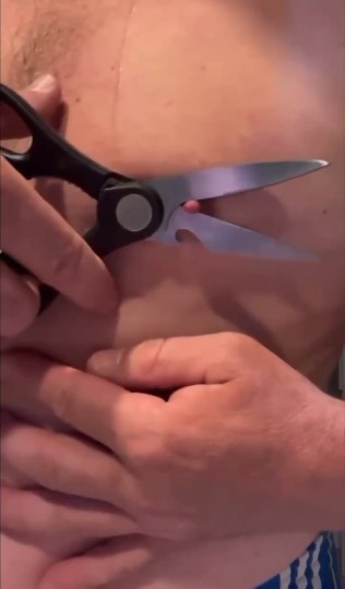 这兄弟真是个狼人啊 ！炸裂 ！ 把自己乳头剪了 看着都觉得疼啊