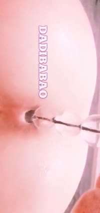 肛门拉珠