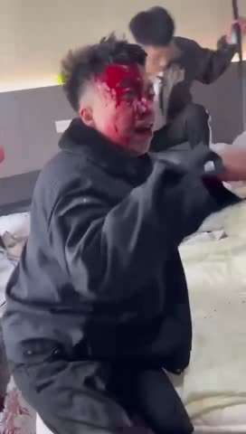 精神小伙被砍