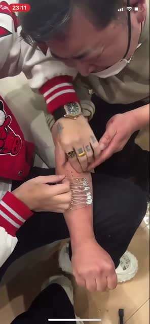 看着都疼，钉子扎进肉里