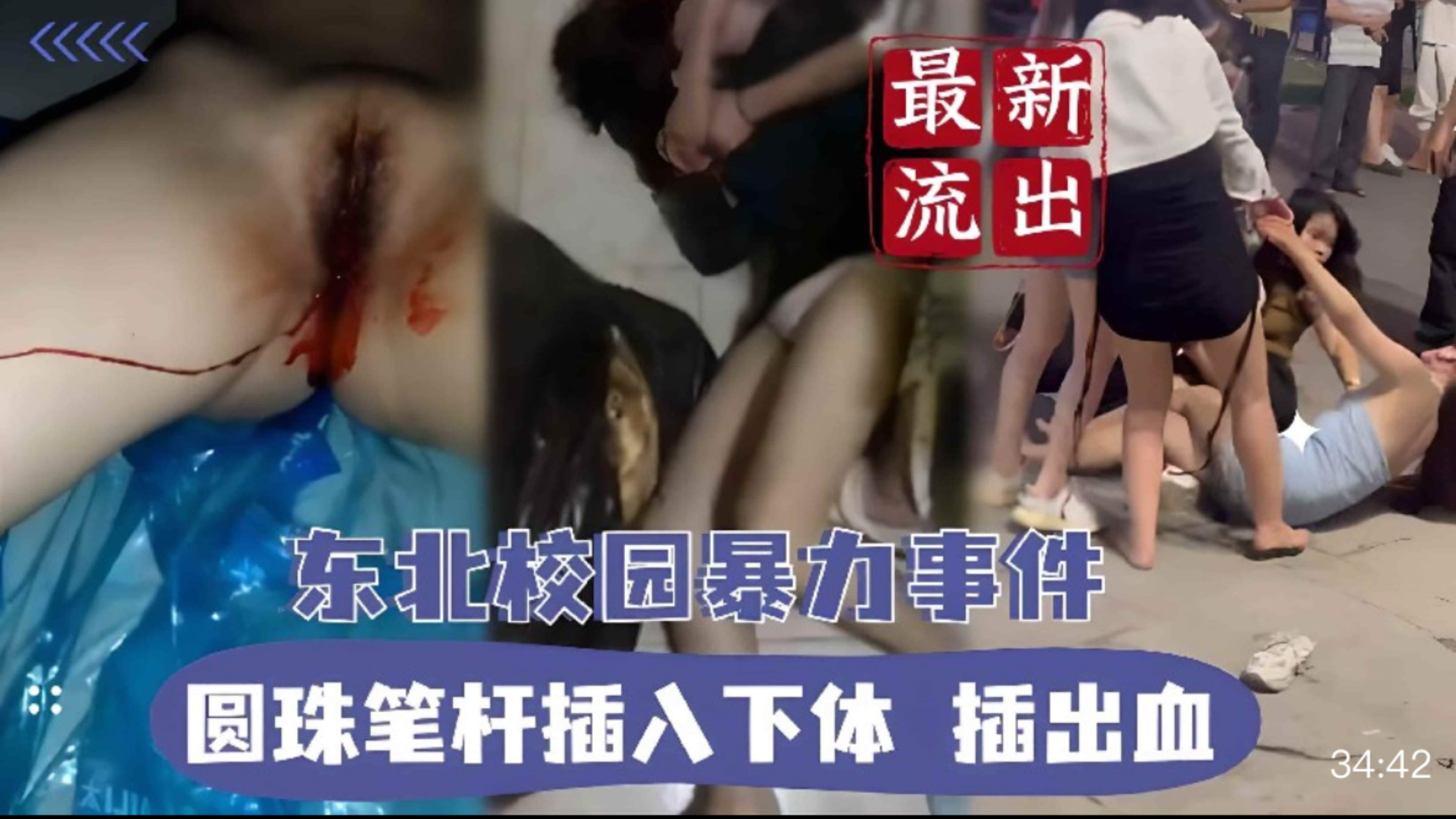 【校园霸凌】东北最狠校园暴力事件圆珠笔疯狂插入下体插出血
