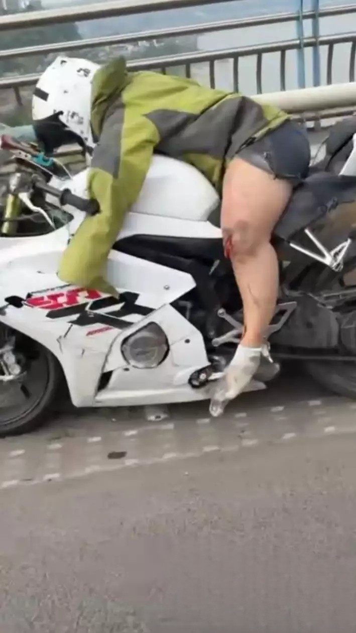 河南郑州花园路东明路口 女骑士摩托车高速死亡摇摆 撞护栏左手腿全断骨髓外流现场惨烈