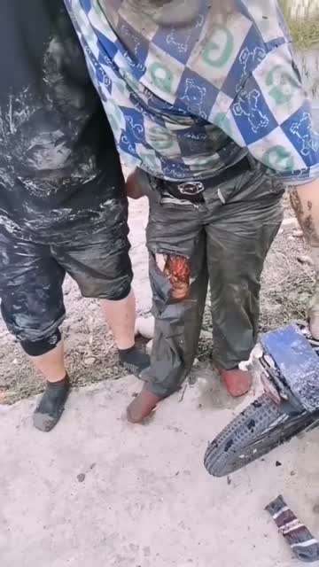 那个？？肉都没有了，